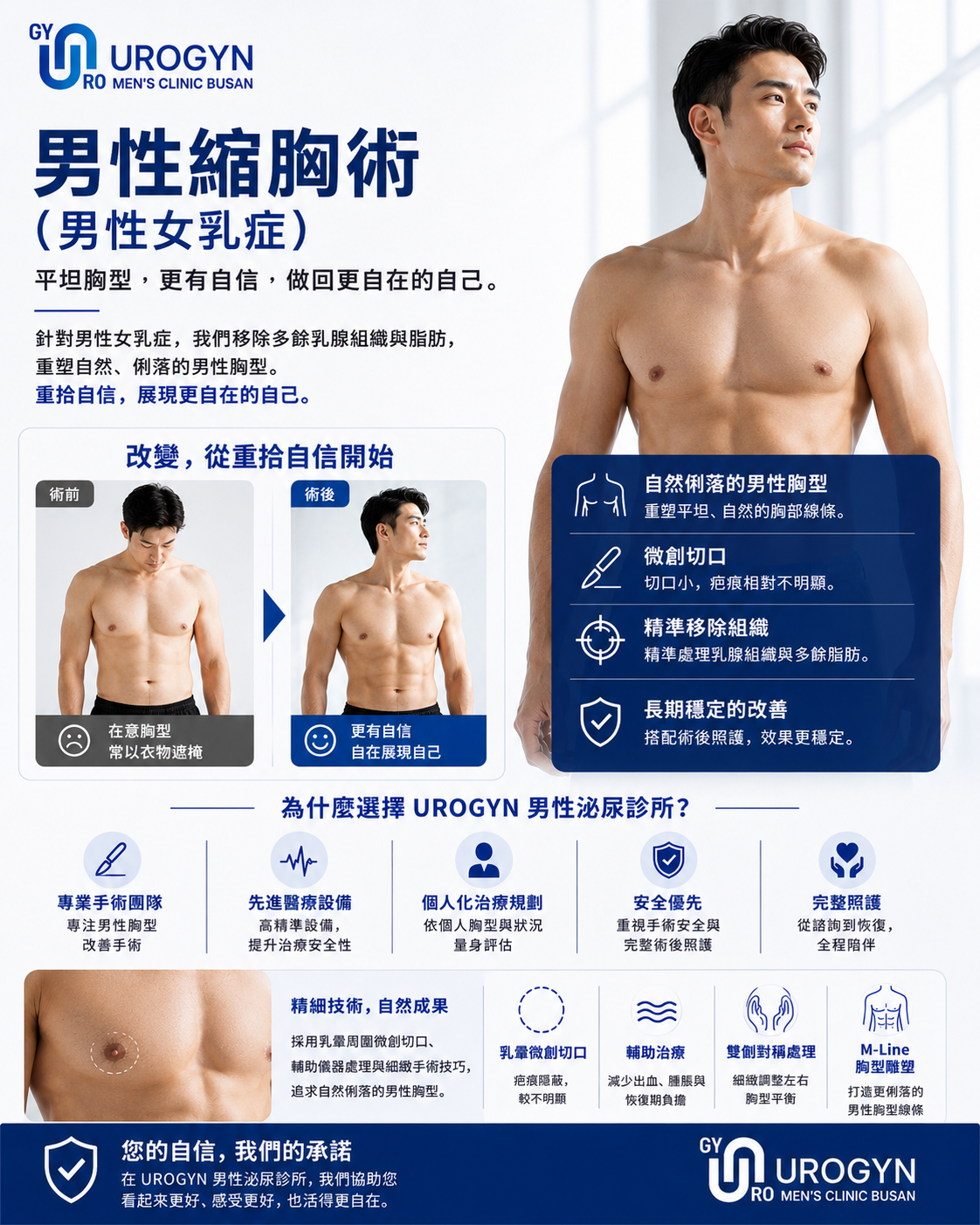 釜山 Urogyn 的男性女乳症手術