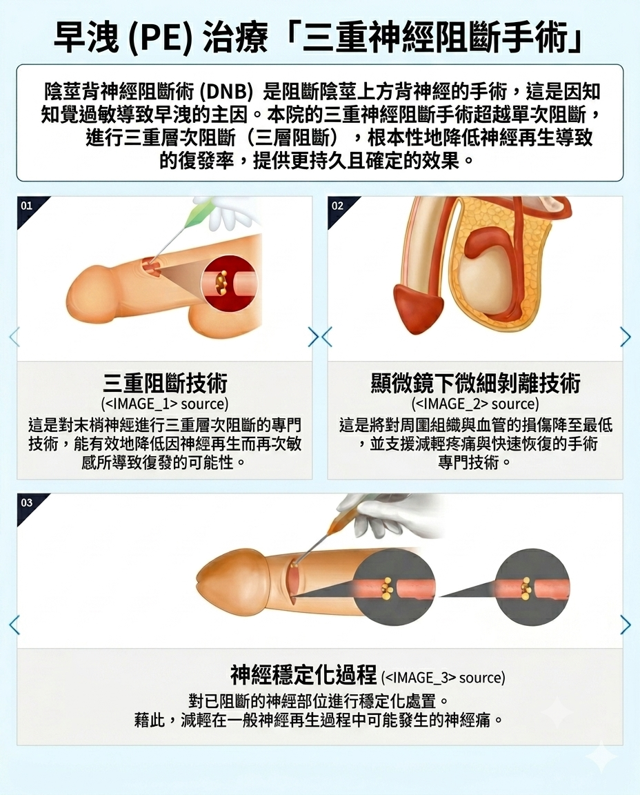 釜山西面 Urogyn 男科診所的三重神經阻斷術手術