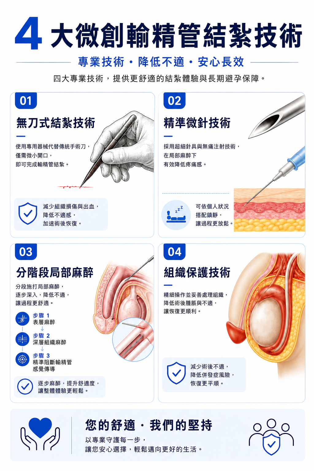 釜山西面 Urogyn 男科診所免開刀輸精管結紮的四種降痛技術