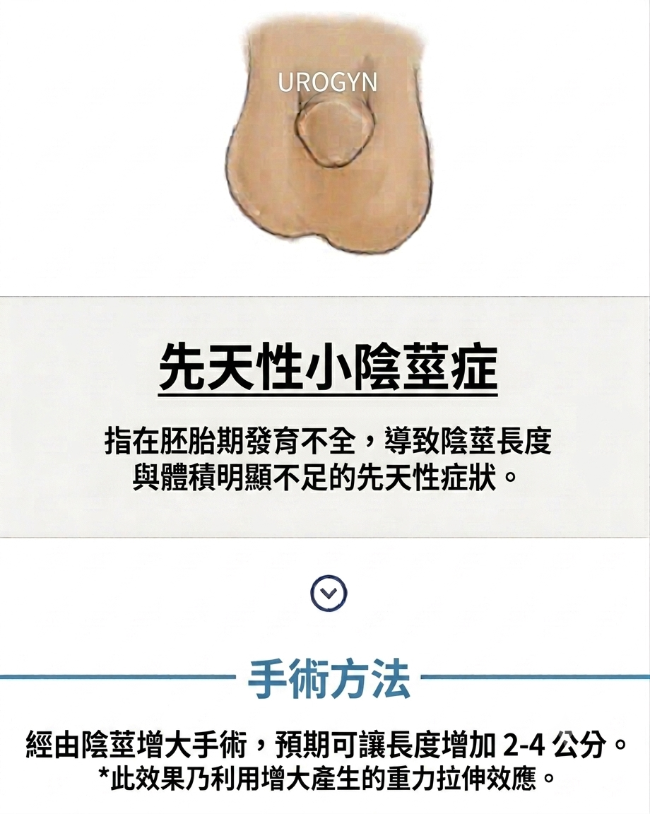 釜山西面 Urogyn 男科診所的成人先天性小陰莖照護療程