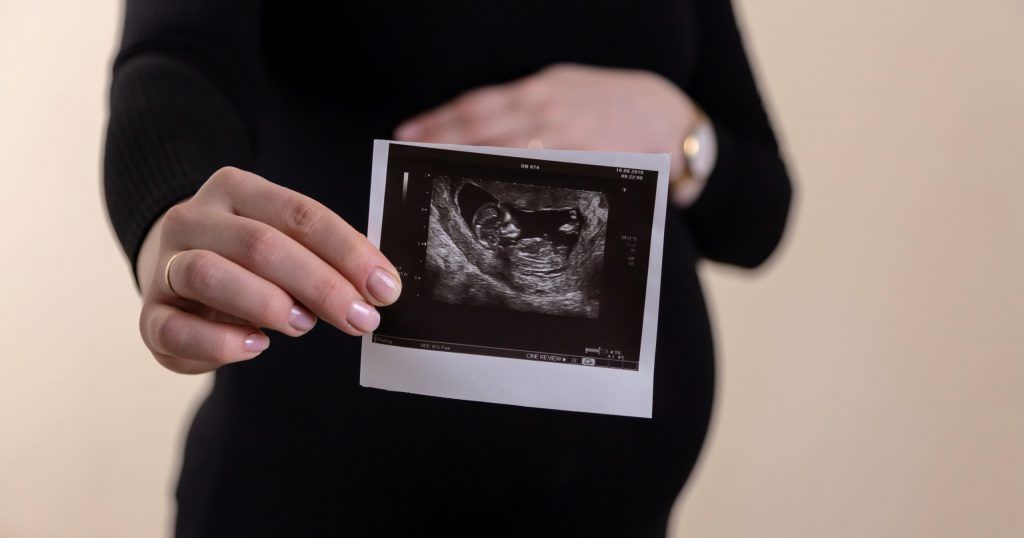 A pregnant woman is holding an ultrasound picture of her baby.