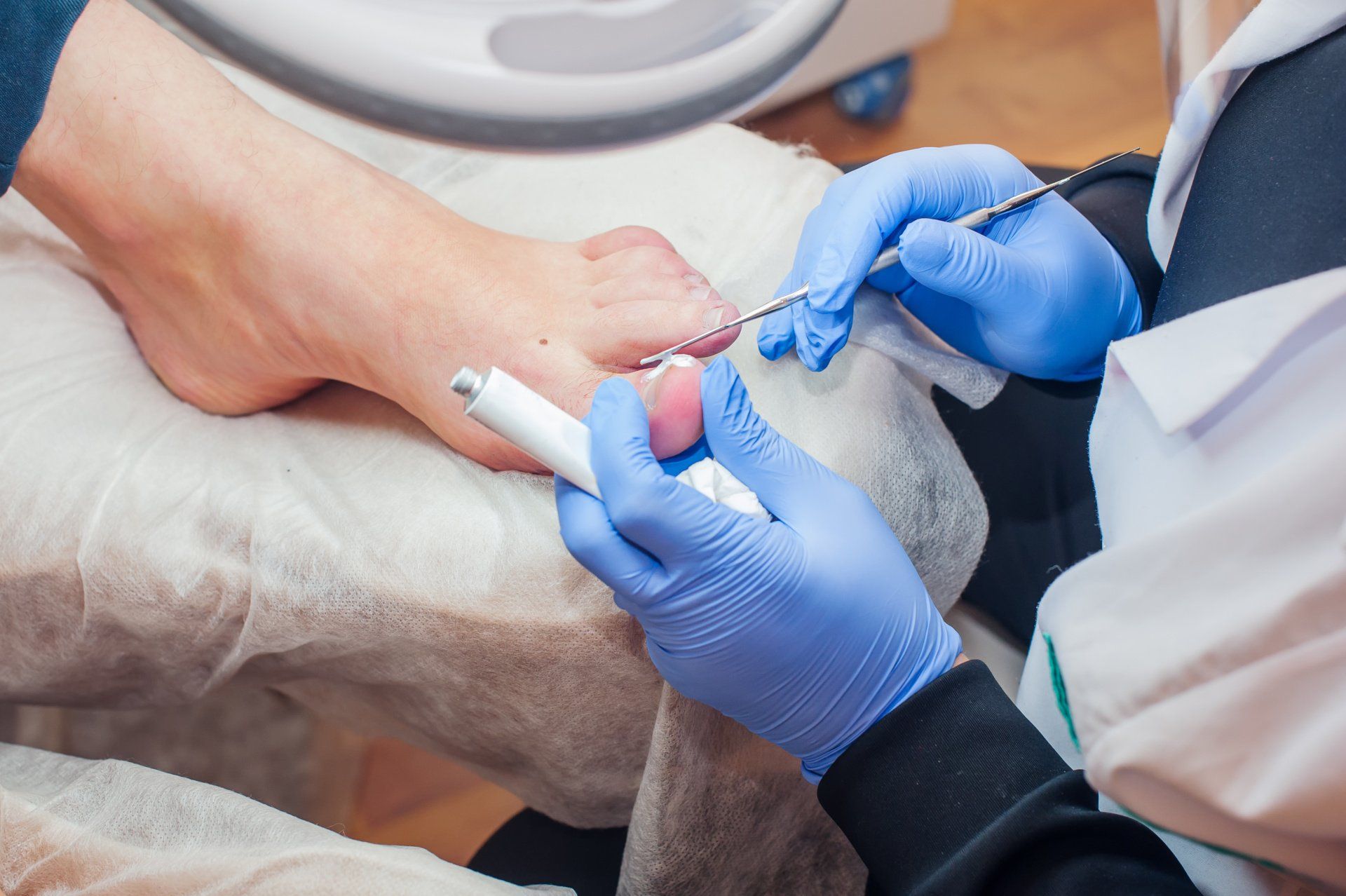 Ingrown Toenail - Cure Podiatry & Wound Care
