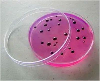 ANÁLISIS CLÍNICOS BACTERIOLÓGICOS SC