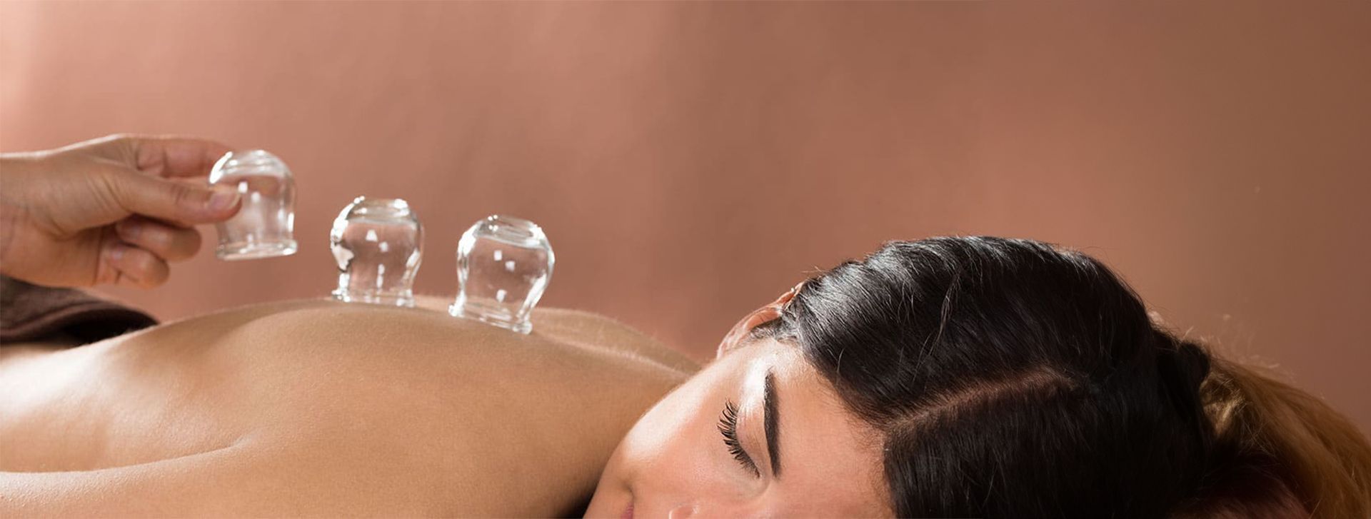 Cupping for Weight Loss – What You Need to Know