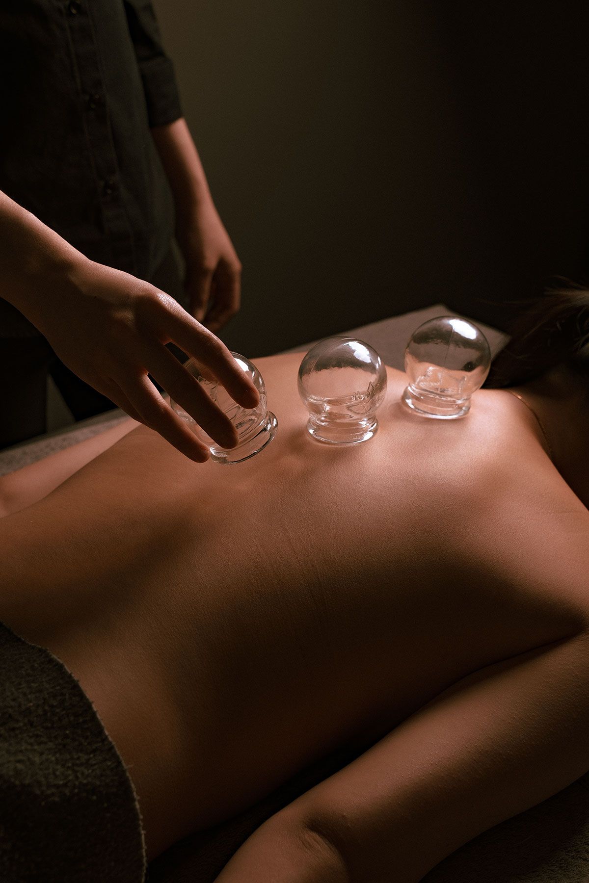 Reasons for the Resurgence of Ba Guan (cupping therapy) in Modern Wellness Practices - Absolute Wellness