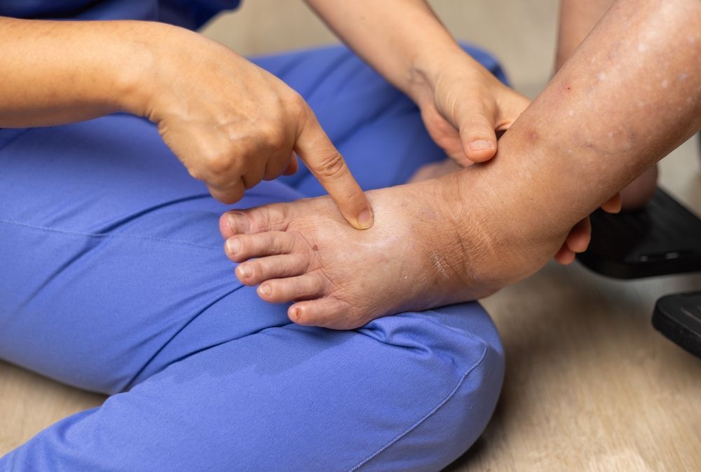 Hands examining a swollen foot and ankle against blue scrubs during a medical exam