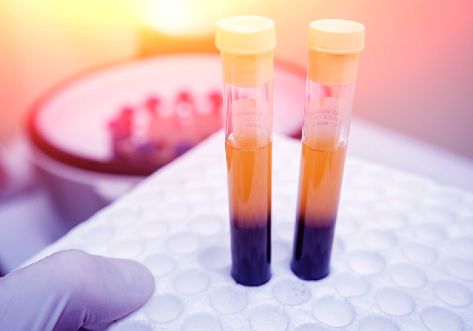 Two blood vials with separated layers, held near a centrifuge.