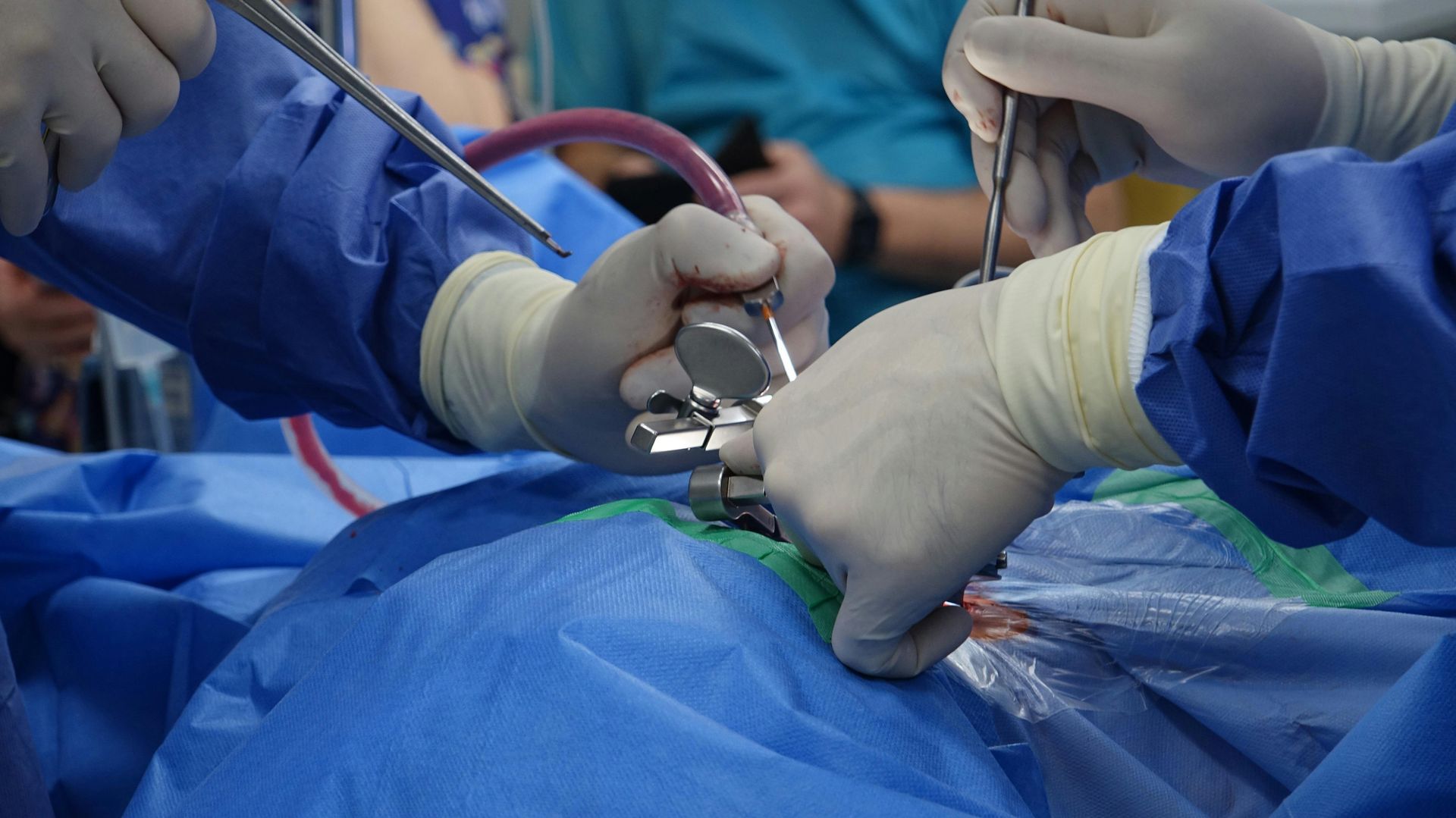 Hands of surgeons in blue scrubs performing surgery with surgical tools.