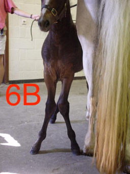 Figuur 6b: X-been links en rechts voor door ongelijke groei ter hoogte van de groeiplaat van de voorknieën X-been door ongelijke groei ter hoogte van de groeiplaat van de voorknieën