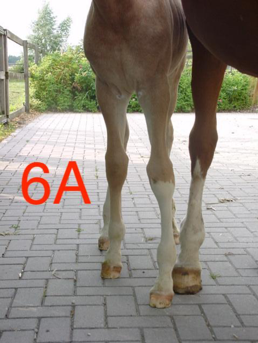 Figuur 6A: Links voor O-been door ongelijke groei ter hoogte van de groeiplaat van de kogel. O-been door ongelijke groei ter hoogte van de groeiplaat van de kogel.