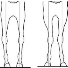 figuur 2: Ee, schets van een paard met O-benen (links) en x-benen (rechts) een paard met O-benen en x-benen