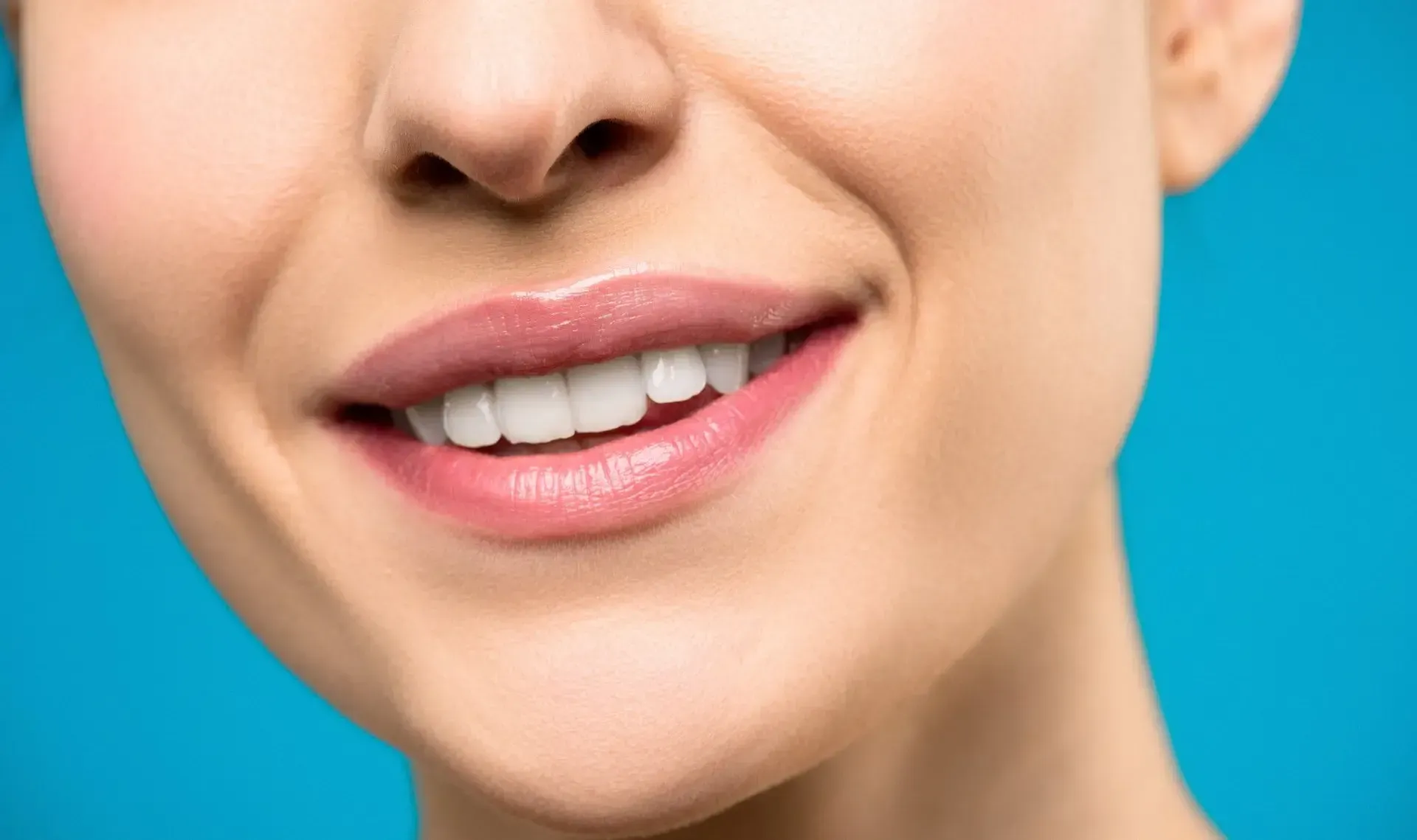 NB Beautiful | LASER TEETH WHITENING