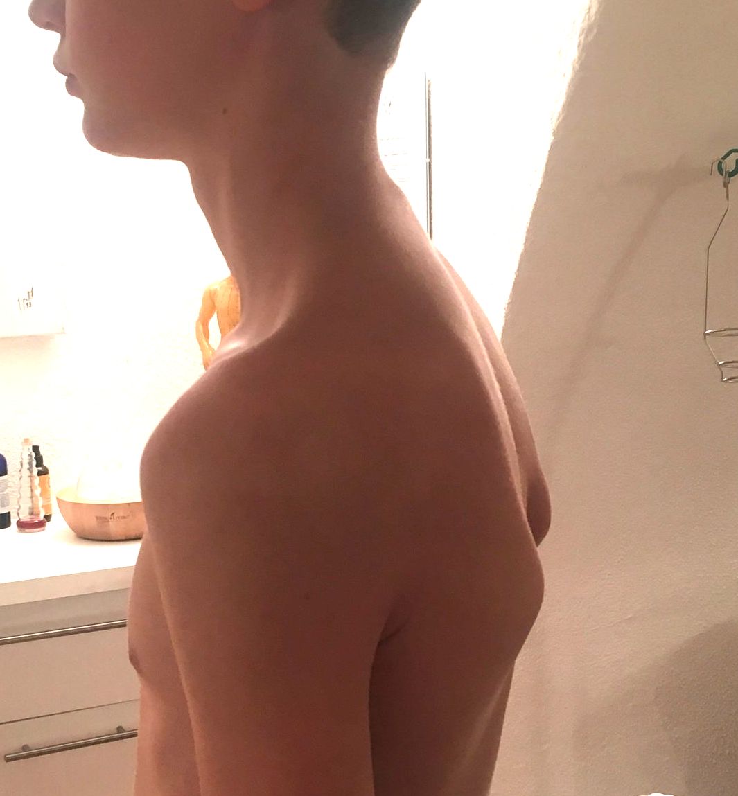 Posture therapy & consciousness control
