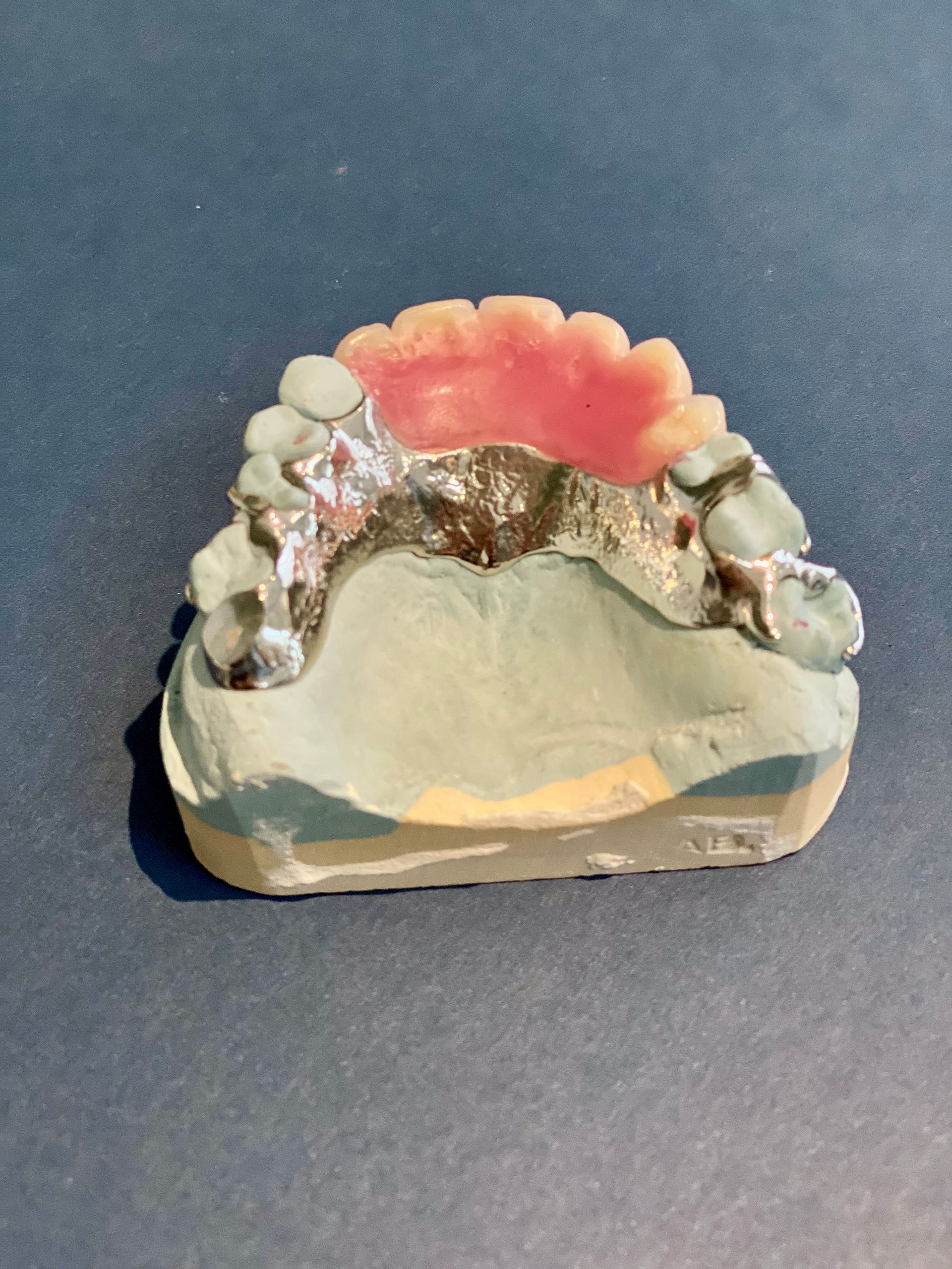Cost of Dentures in Adelaide