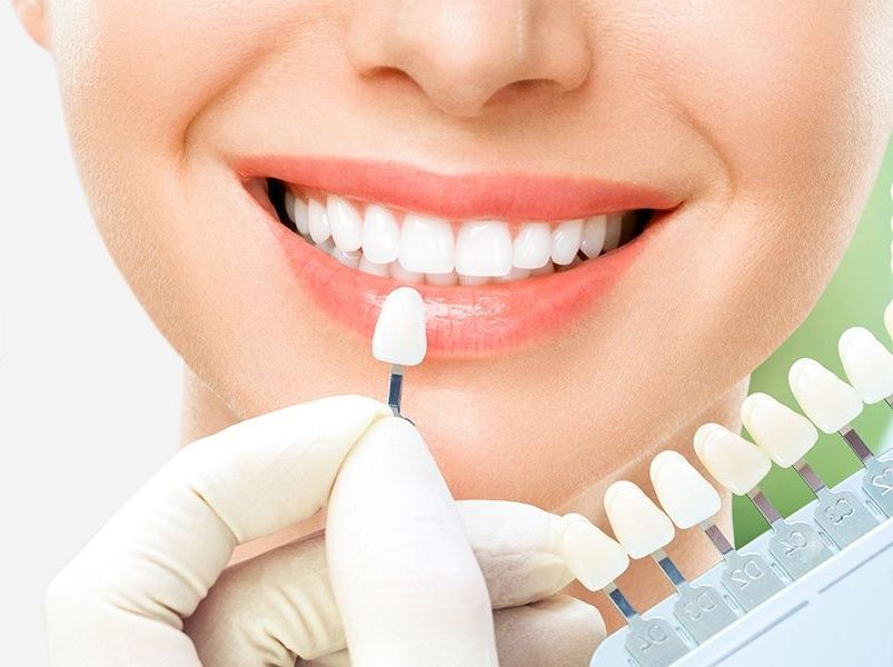 Cosmetic Dental in Adelaide