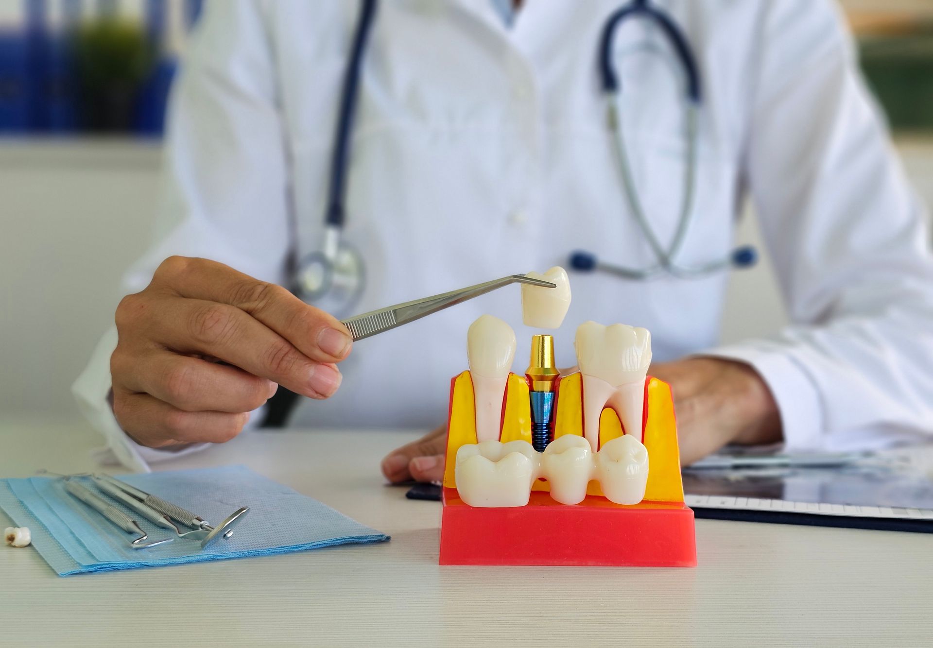 A dentist is holding a model of a dental implant.