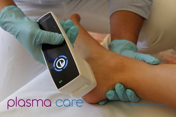 Behandschuhte Hände bedienen ein Plasmabehandlungsgerät am Fuß eines Patienten während einer Behandlungsprozedur