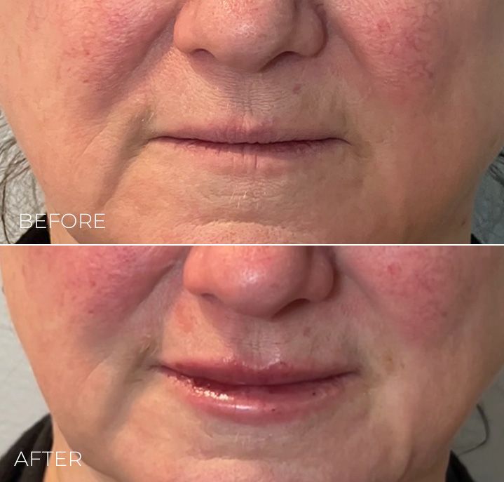 A before and after photo of a woman 's face.