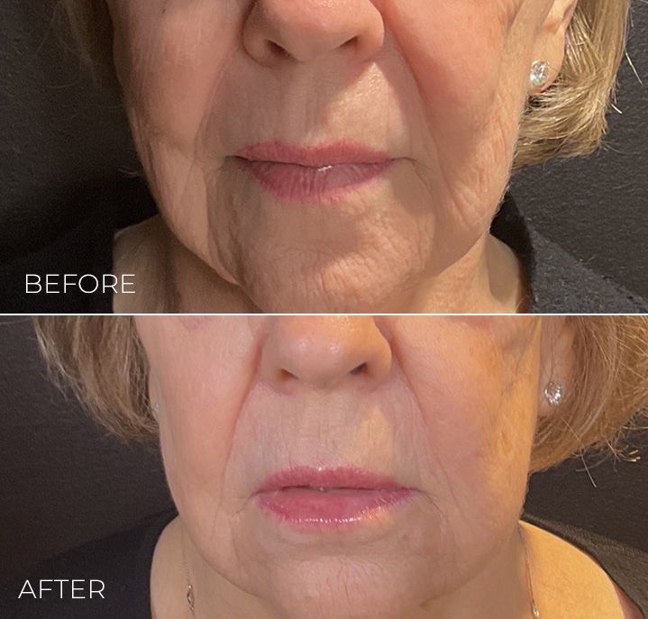 A before and after photo of a woman 's face