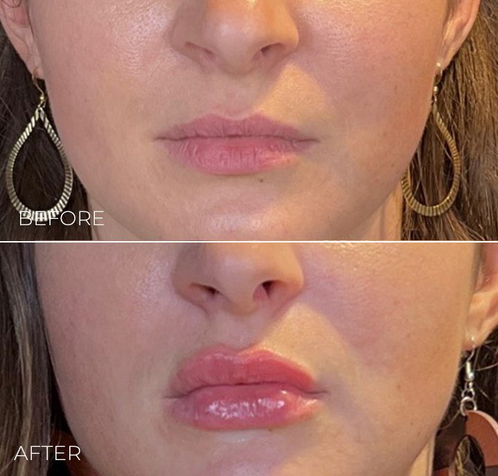 A before and after photo of a woman 's face