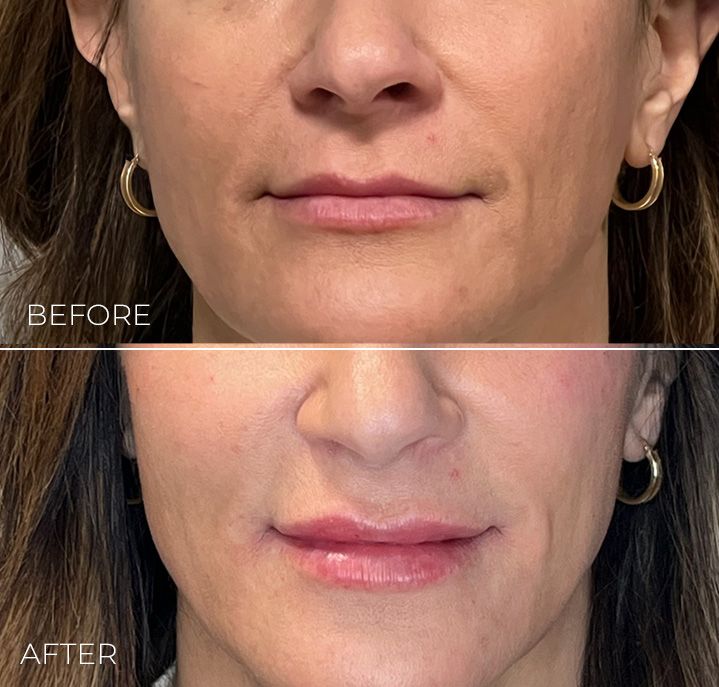 A before and after photo of a woman 's face