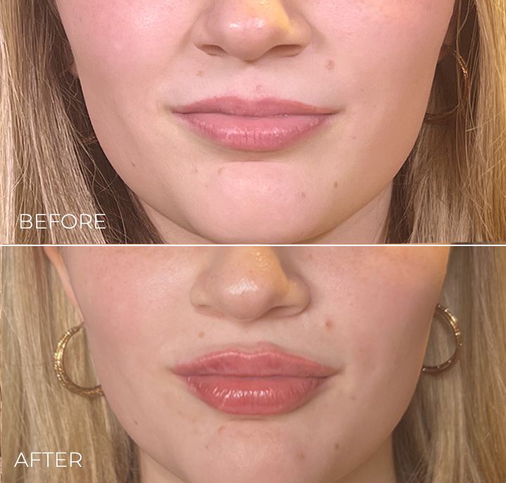 A before and after photo of a woman 's face