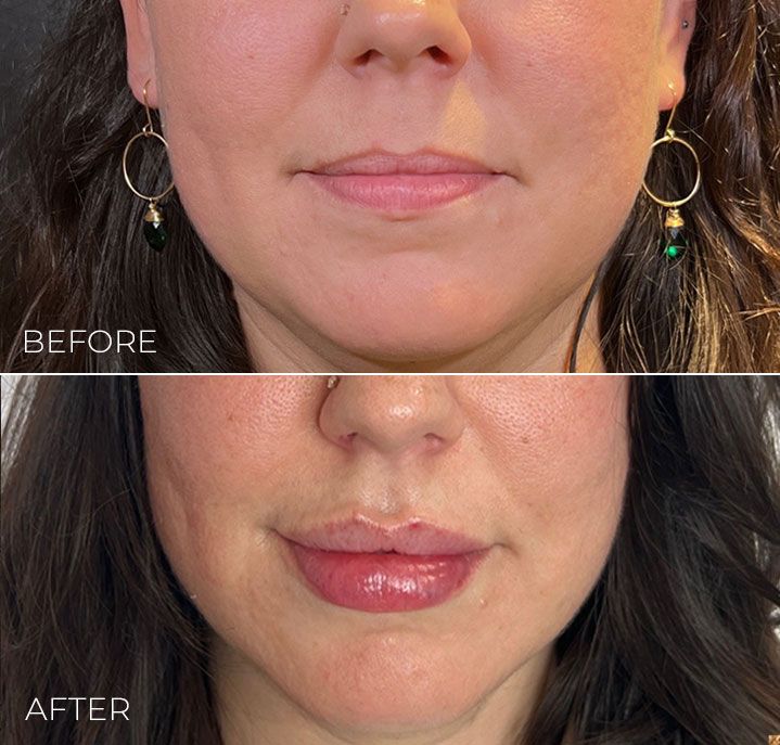 A before and after photo of a woman 's face