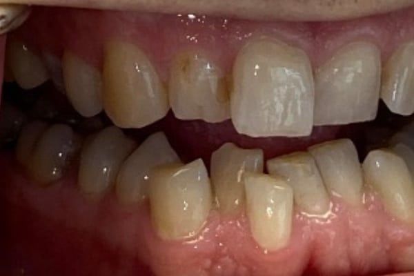 Cosmetic & Invisalign