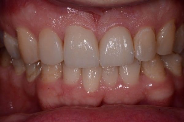 Cosmetic & Invisalign