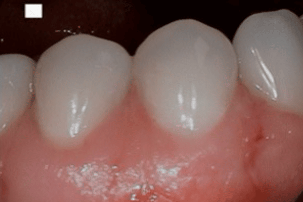 Dental Emergency After