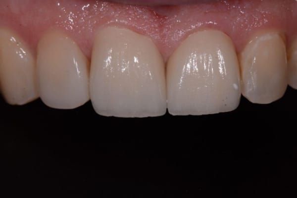 Cosmetic & Invisalign