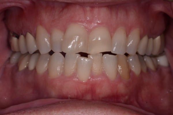 Cosmetic & Invisalign