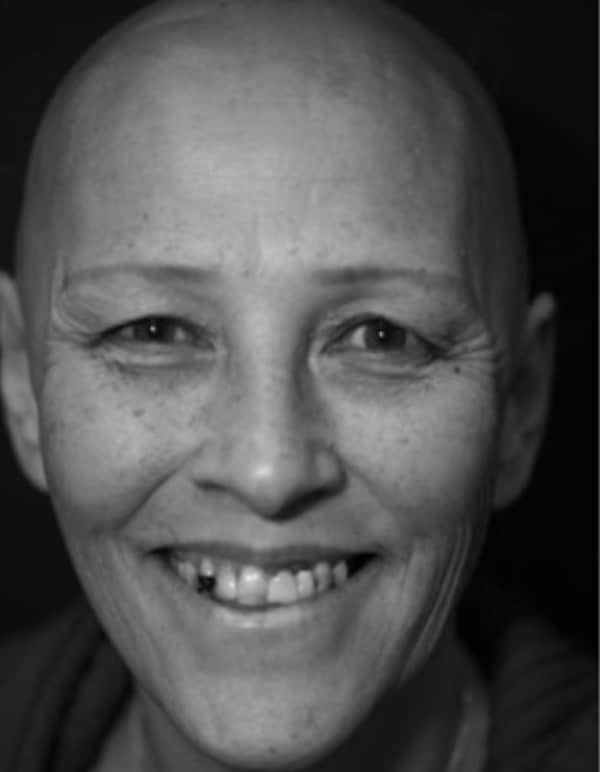Before Smile Makeover