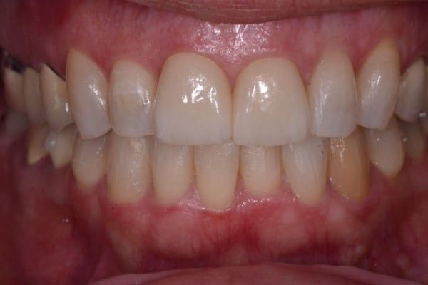 Cosmetic & Invisalign