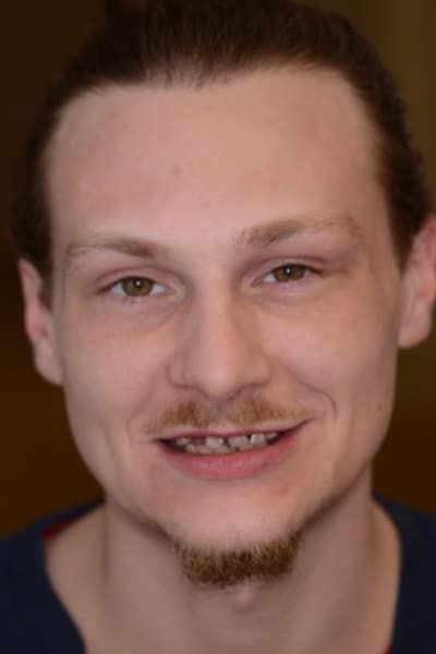 Case B Before Portrait