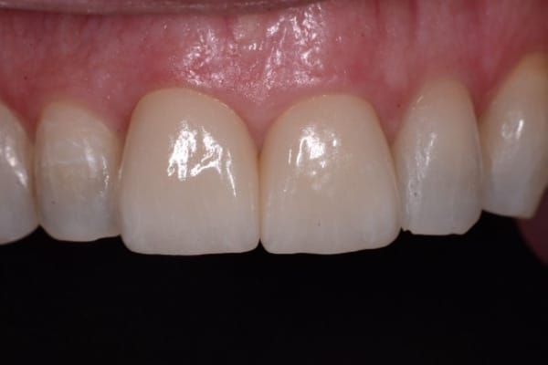 Cosmetic & Invisalign