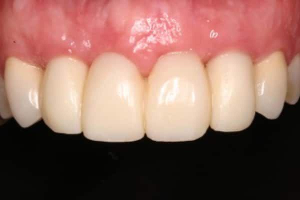Dental Emergency After