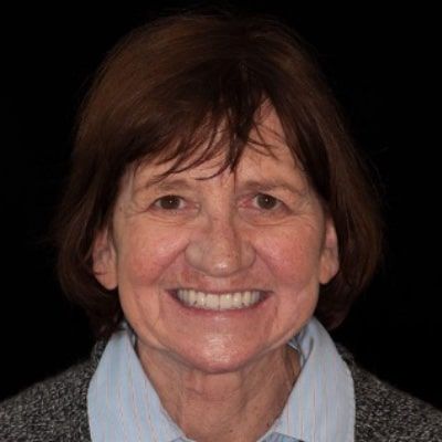 Case B After Portrait