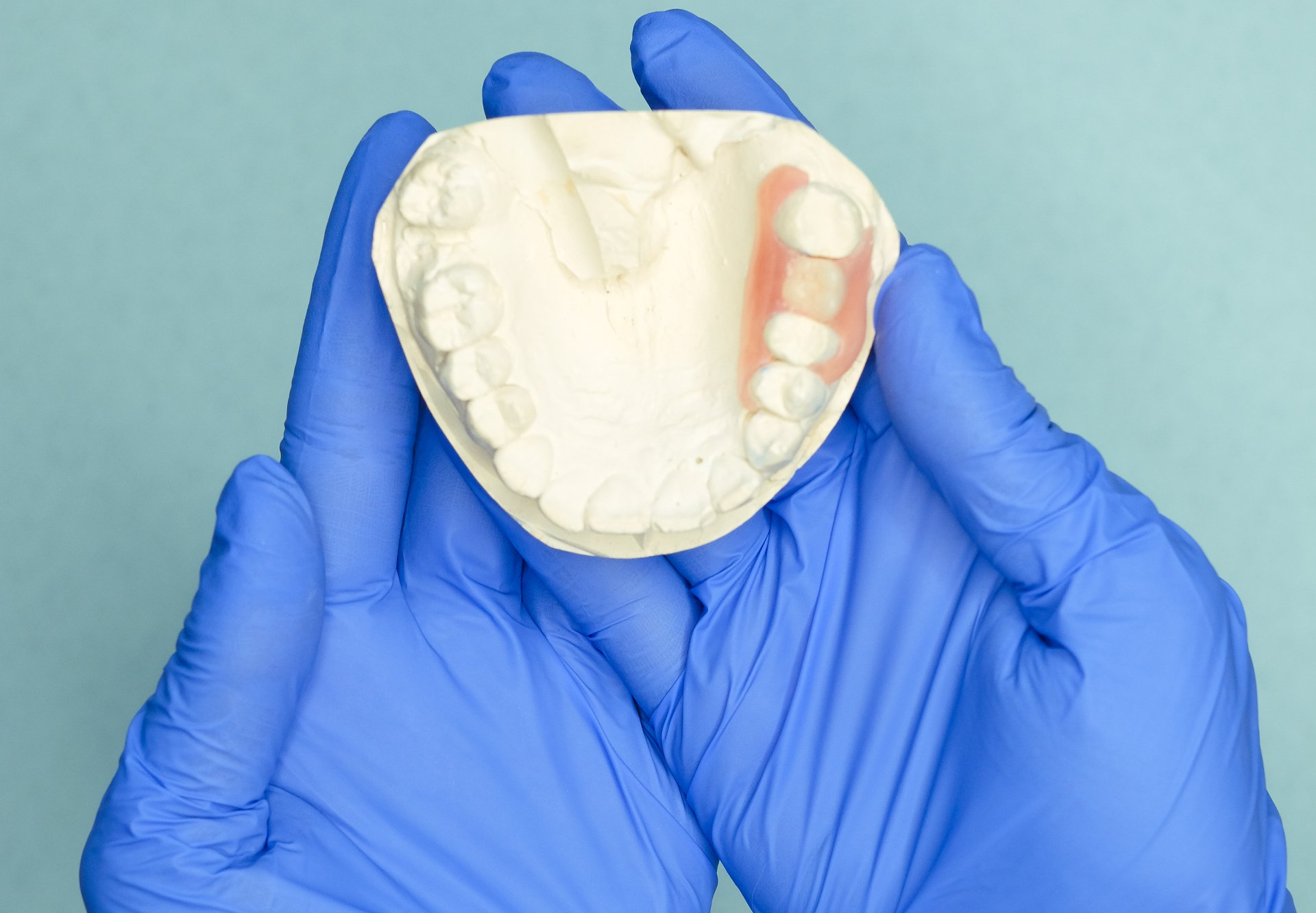 dental bridge mold Dental Arts Studio of Cape COD