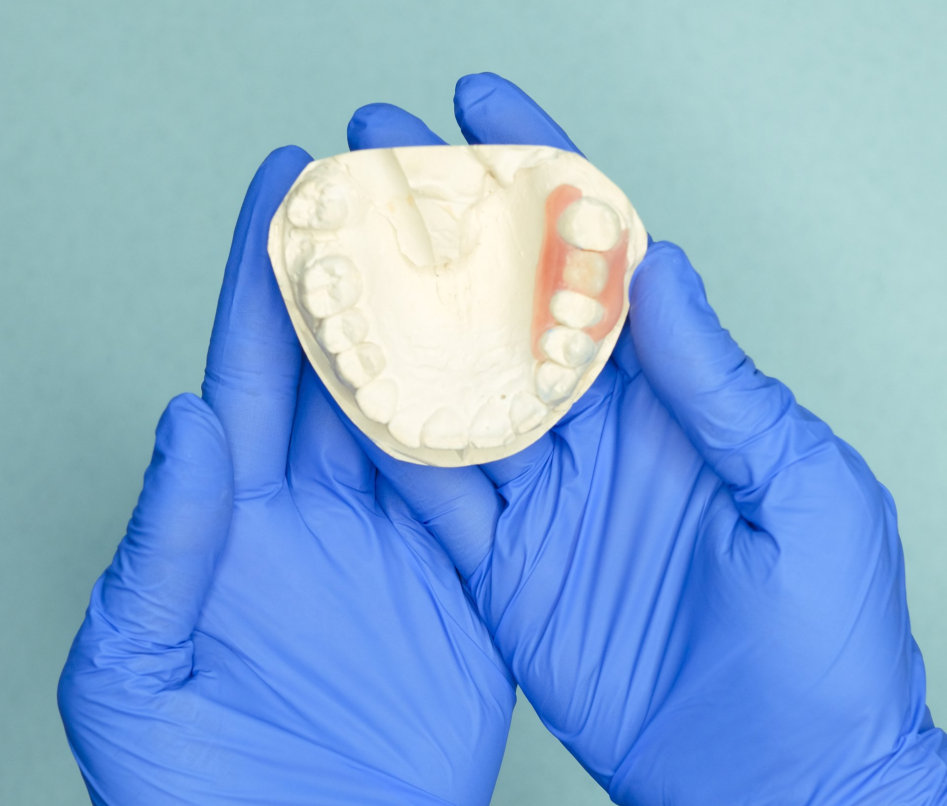 Dental Crown