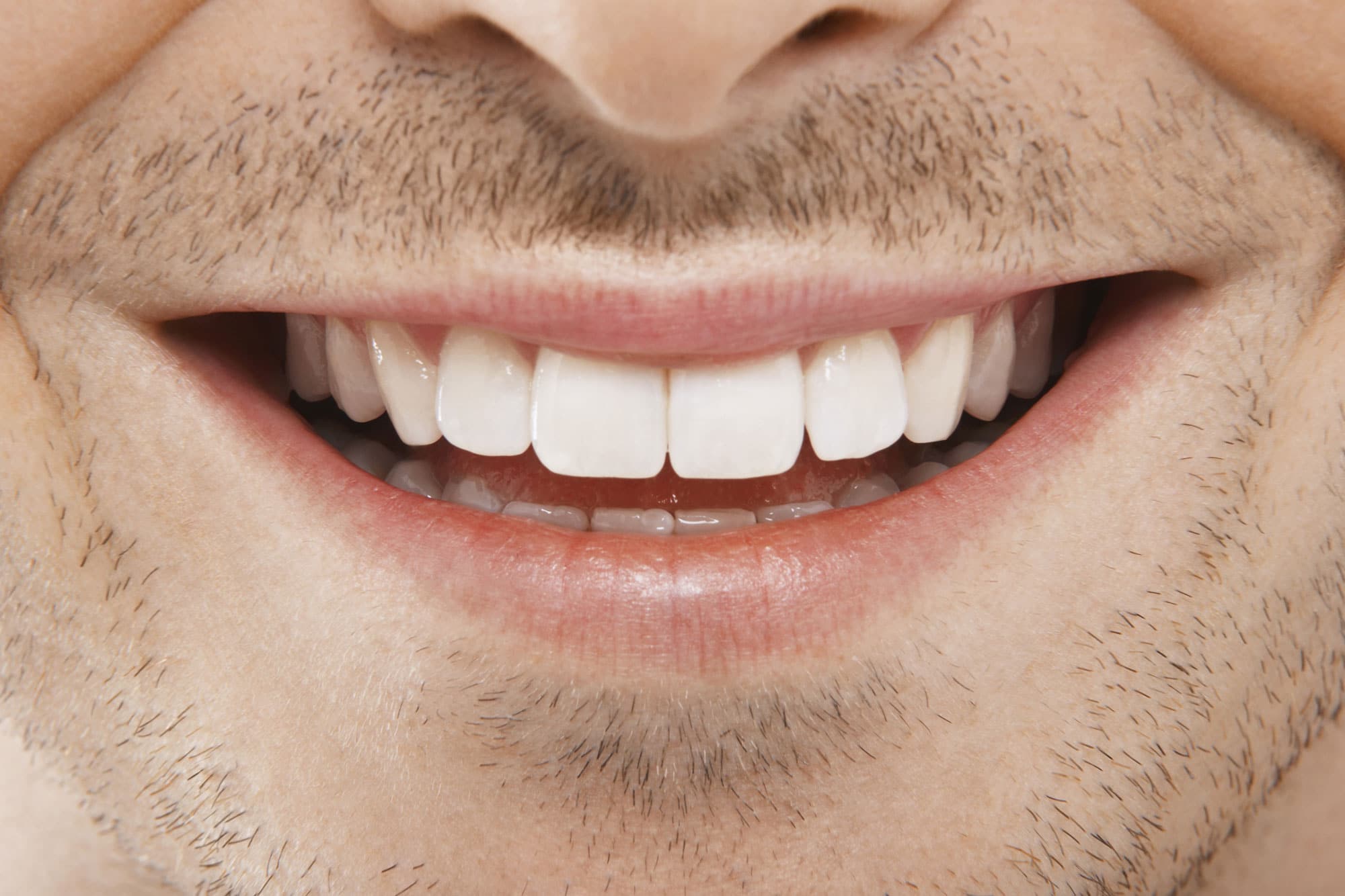 laser gingivectomy treatment