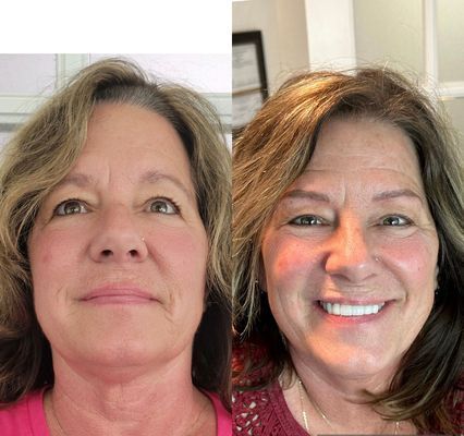 Blade to Beauty Eyebrow Microblading Before and After