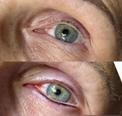 Close-up of two blue-green eyes with wrinkled skin around them, one above the other on a tilted face