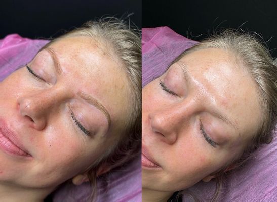 Blade to Beauty Eyebrow Microblading 