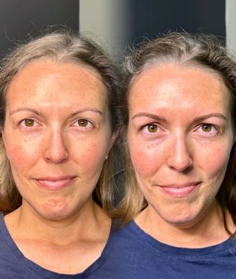 Blade to Beauty Eyebrow Microblading Before and After