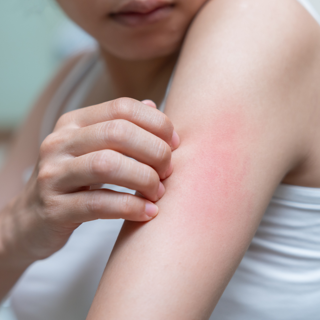 A woman is scratching her arm with her hand.