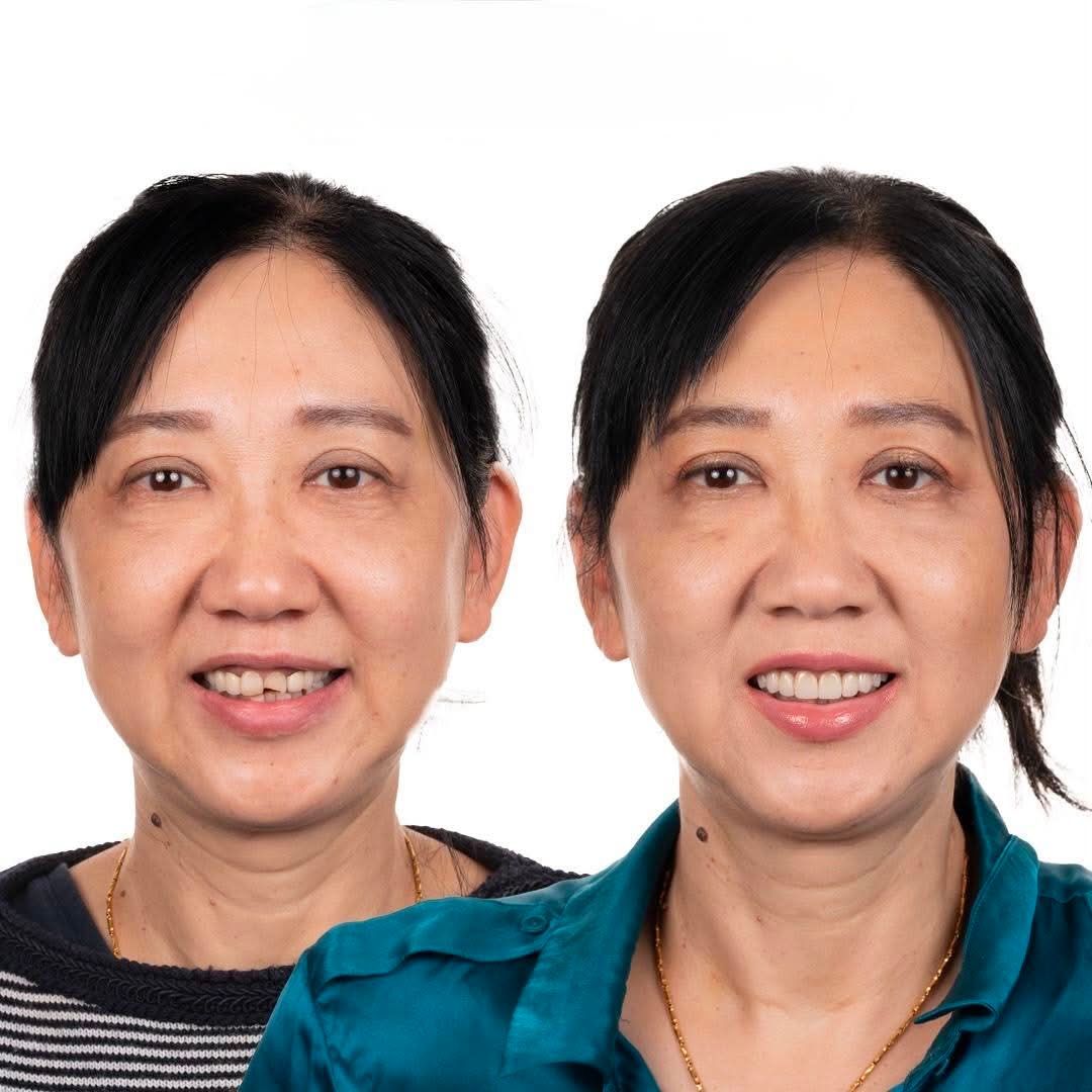 bupa dentist near me