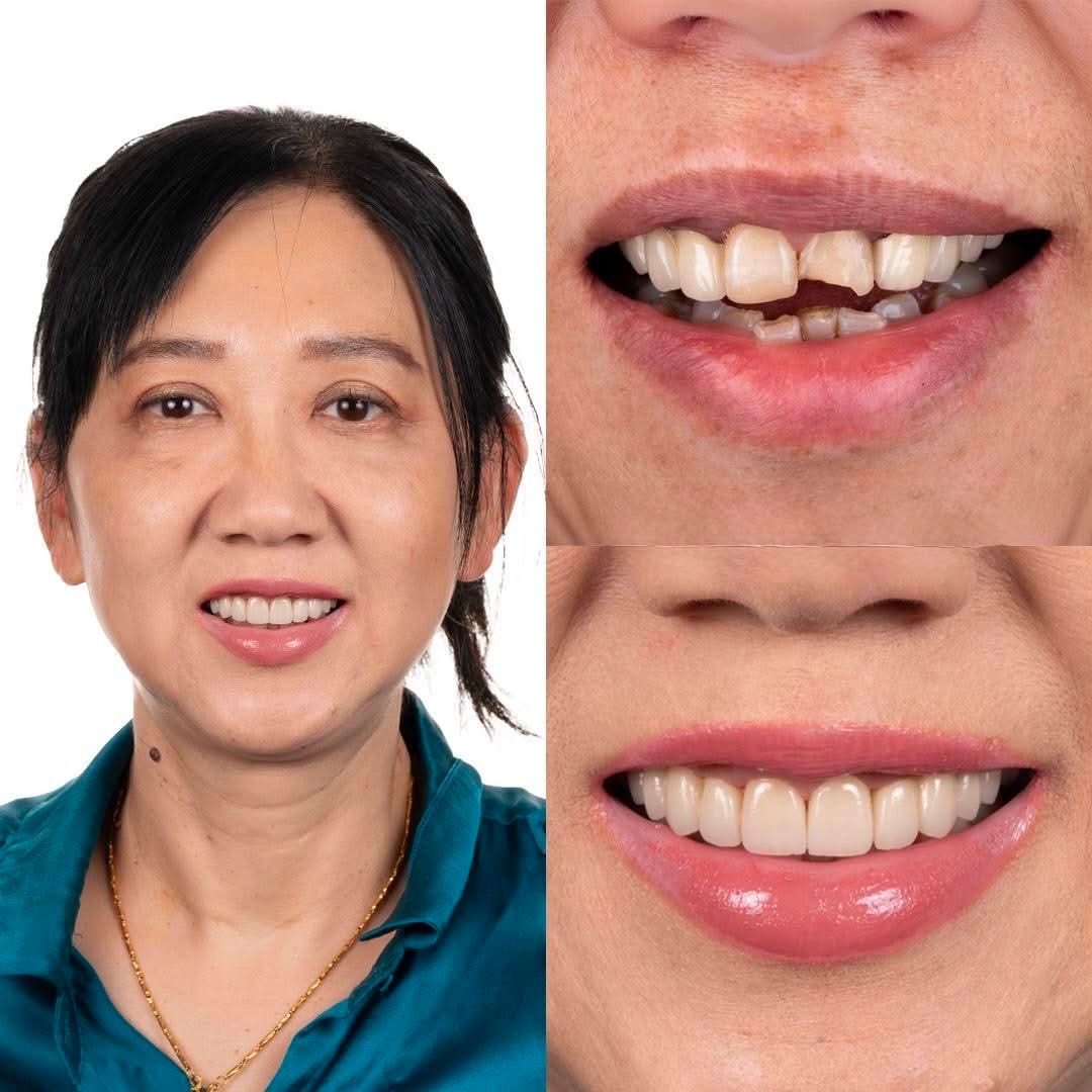 hbf health fund dentist near me