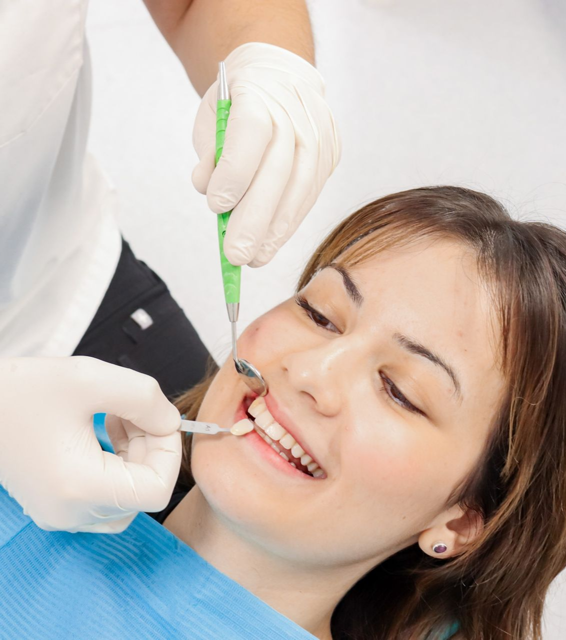 DENTAL Veneers Sydney