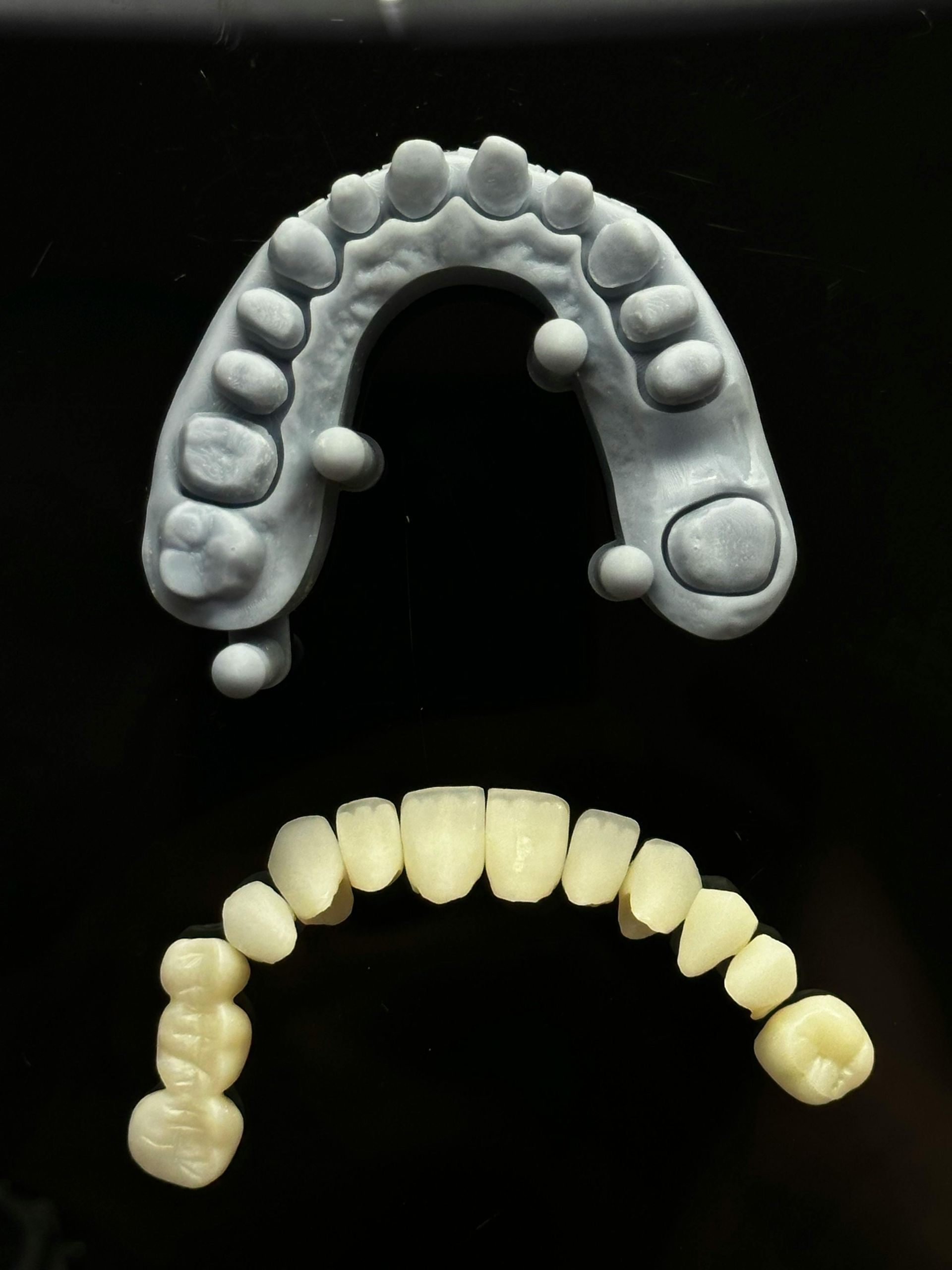 dental bridge and dental crown bankstown